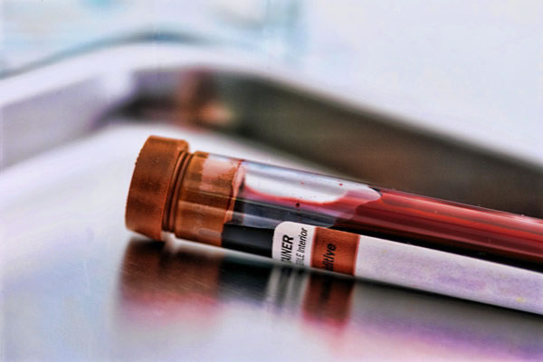 Quanto tempo faz que você não faz um exame de sangue em Sao Paulo? Pode fazer pelo convênio ou não?