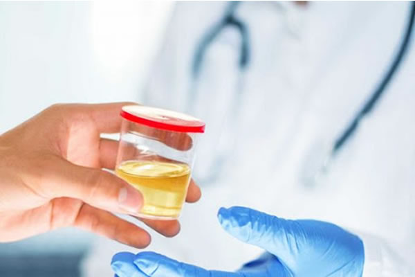 Esta sofrendo com infecção urinária? Utilize um convênio médico para Tratamento!