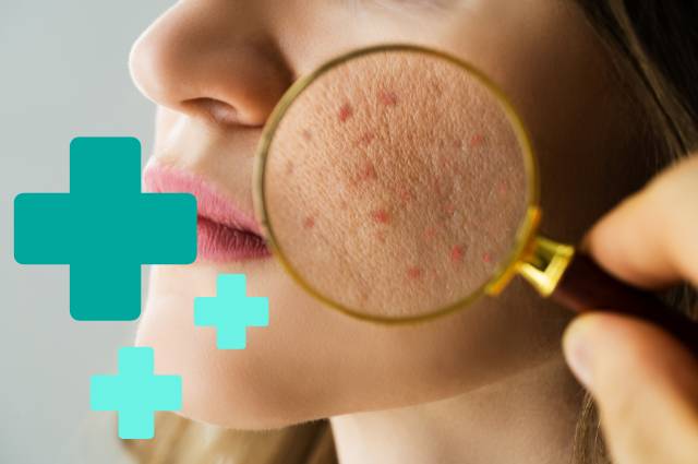 Tenha um dermatologista com o plano